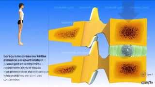Le disque intervertébral vidéo sonorisée [upl. by Constancia]