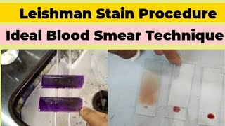 Leishman Stain Procedure and Blood Smear Preparation for DLC Count [upl. by Dygall352]