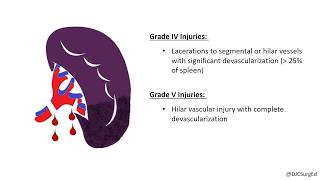 Splenic Injury [upl. by Chaunce67]