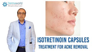 Isotretinoin capsules  Treatment for Acne removal  In Hindi  Dr Rohit Batra [upl. by Okramed]