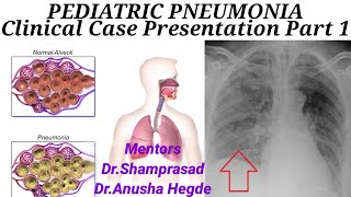 PEDIATRIC PNEUMONIA Part 1 Clinical Case Presentation [upl. by Ramraj]