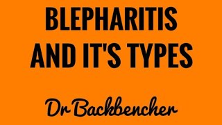 Blepharitis  Types causes clinical features and treatment  Ophthalmology [upl. by Anirbus291]