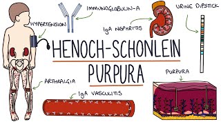 HenochSchonlein Purpura Visual Explanation for Students [upl. by Nynahs494]