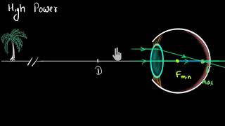 Myopia amp Hypermetropia Hindi  Human eye and the colourful world  Physics  Khan Academy [upl. by Haidebej]