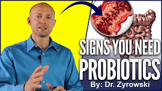 Probiotic Benefits  Top Signs You Should Be Taking A Probiotics [upl. by Nomi225]