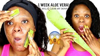 1 WEEK ALOE VERA TREATMENT ON MY FACE amp THIS IS WHAT HAPPENED  OMABELLETV [upl. by Ledah]