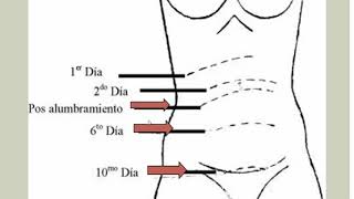 Puerperio Normal  Obstetricia  Clase 81 [upl. by Legna]