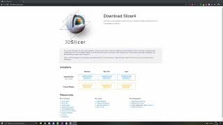 3D Slicer Tutorial 1 Basics [upl. by Daughtry269]