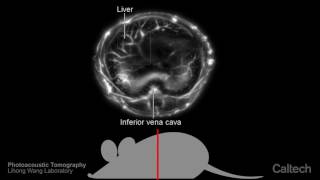 Photoacoustic Tomography  Lihong Wang Lab [upl. by Airebma]