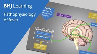 Pathophysiology of fever explained [upl. by Amzu819]