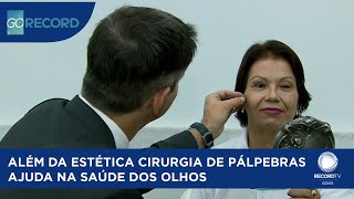 ALÉM DA ESTÉTICA CIRURGIA DE PÁLPEBRAS AJUDA NA SAÚDE DOS OLHOS [upl. by Keg380]