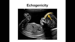 Introduction to Ultrasound  01  Fundamentals [upl. by Freemon]