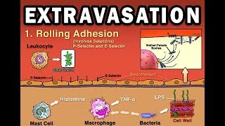 EXTRAVASATION [upl. by Shedd]