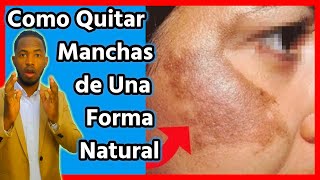 Tratamiento casero para las MANCHAS EN TU CARA es totalmente natural [upl. by Salina]