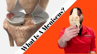 What Is A Meniscus  Do I Need Surgery For A Meniscus Tear  Knee Pain Explained [upl. by Savannah209]