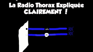 🔴 Dr Astuce  1 LA RADIO THORAX EXPLIQUÉE CLAIREMENT [upl. by Esinehc245]