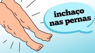 INCHAÇO NAS PERNAS O QUE PODE SER [upl. by Urbannal]