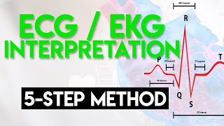 ECG Interpretation Made Easy  ECG EKG Interpretation Part 2 [upl. by Niveg75]