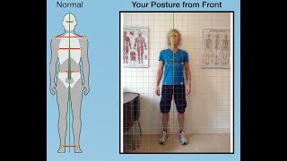 Postural Assessment Guide [upl. by Aicatsanna]