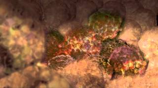 Cancer Cells Undergoing Mitosis [upl. by Romie]