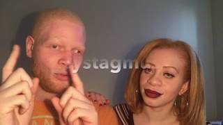 Albinism amp Nystagmus [upl. by Kenton]