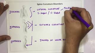 Spine Curvature Disorders  Scoliosis Kyphosis Lordosis [upl. by Refotsirk]