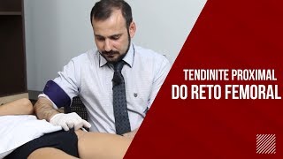 Tendinite Reto Femoral CUIDADO COM A ARTÉRIA [upl. by Nilpik]