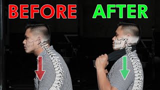 Restore Your Neck Posture amp Curve  Cervical Lordosis [upl. by Aivil]