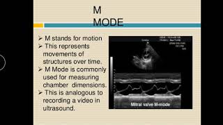 Modes of ultrasound imaging [upl. by Farand]