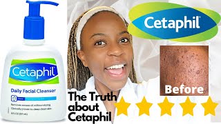 Cetaphil Skin Care Cleanser Review  Agnater [upl. by Marga]