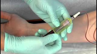 Sample Procedure  Venipuncture Butterfly Method [upl. by Marabelle915]