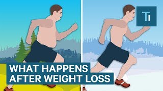 What Losing Weight Does To Your Body And Brain  The Human Body [upl. by Hoffer]