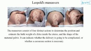 Leopolds maneuvers [upl. by Damaris22]