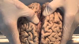 How the human brain works [upl. by Yngad]