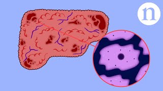 Scar wars Repairing the liver [upl. by Sergeant490]