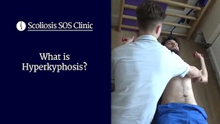 What is Hyperkyphosis  Scheuermanns Disease amp Bad Posture [upl. by Misty]