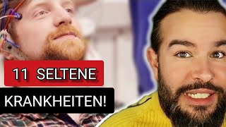 Seltene psychische Krankheiten DAS kennen die meisten nicht [upl. by Schwing]