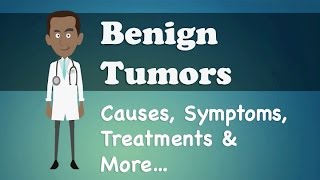 Benign Tumors  Causes Symptoms Treatments amp More… [upl. by Iridissa979]