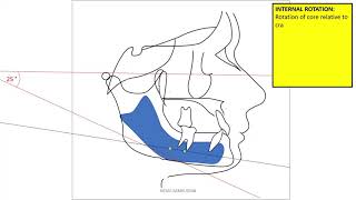 mandibular rotation [upl. by Neiman]