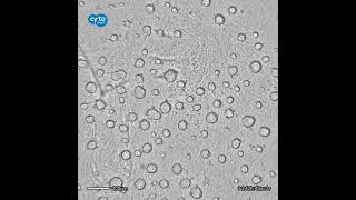 Time lapse of HepG2 selfassembly into multicellular spheroids  CytoSMART Lux2 [upl. by Nalyt]