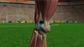 Lesiones de rodilla [upl. by Emrich102]