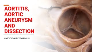 AORTITIS AORTIC ANEURYSM AND DISSECTION [upl. by Anicul]