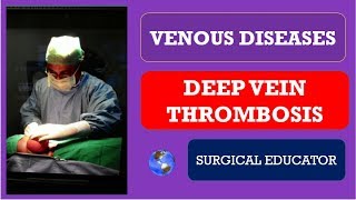 Understanding and Diagnosing Venous Thromboembolism VTE [upl. by Arakahs]