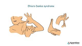 Disorders of the basal ganglia [upl. by Cornelia]