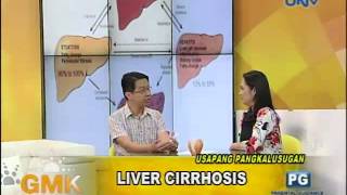 Understanding Liver Cirrhosis [upl. by Egdamlat]