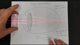 Vision Correction Normal Eyes Myopia Hyperopia Near amp Far Point Lens Power [upl. by Nedrob]