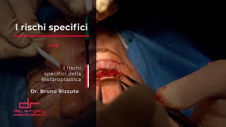 I RISCHI SPECIFICI dellIntervento di Blefaroplastica [upl. by Onilecram209]