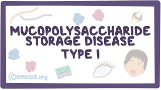 Mucopolysaccharide Storage Disease Type I Hurler HurlerScheie and Scheie syndromes [upl. by Assirrak]