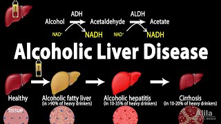 Alcoholic Liver Disease Animation [upl. by Kappel]