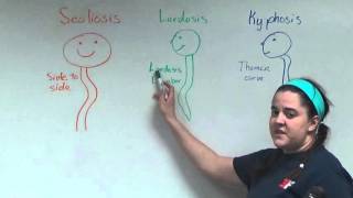 Scoliosis Lordosis and Kyphosis [upl. by Ailero875]